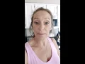 2 weeks with Immediate Dentures