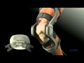 The DonJoy Difference in Knee Braces
