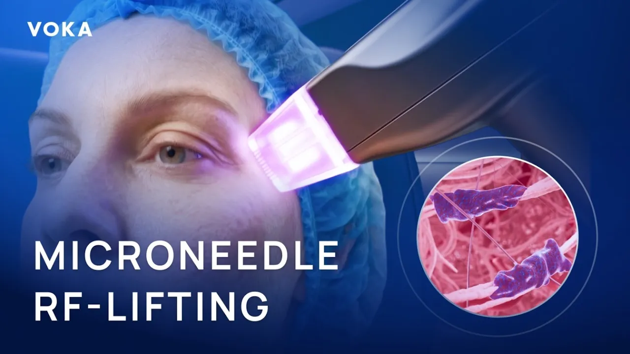 VOKA microneedle RF-lifting animation