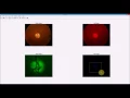 disk extraction from retina image code from scratch