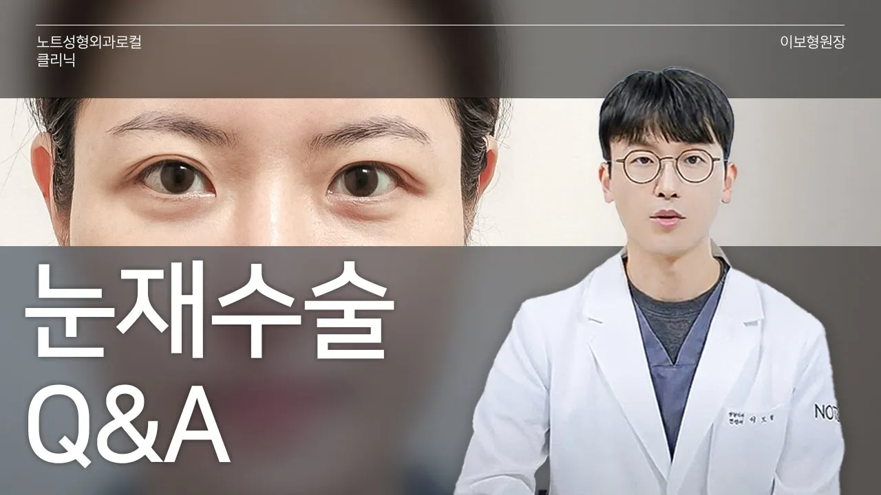[이보형 원장의 Q&A] 눈재수술 특집 l 재수술 시기 l 매몰 재수술 l 회복 기간