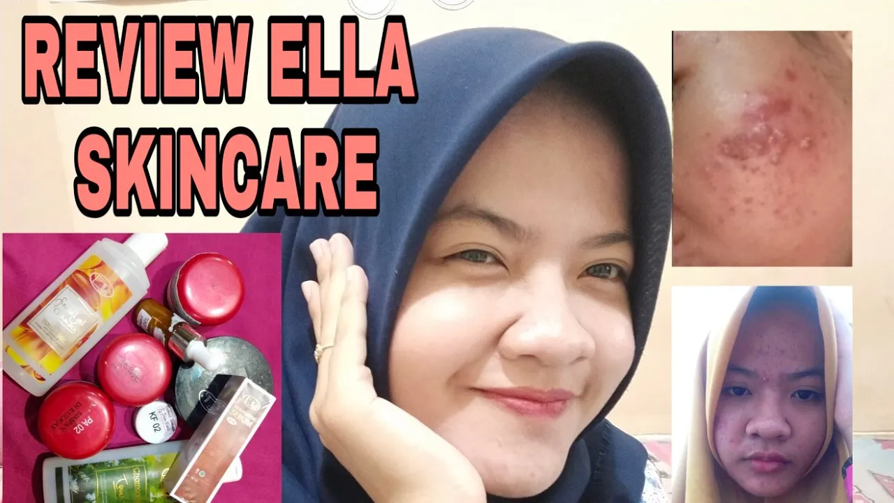 Hi Friends, Di video #ASKElla kali ini kita akan menjawab pertanyaan seputar Glowing Skin yang sudah. 