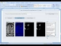 TSYS MEDICAL IMAGE PROCESSING PROJECT IN JAVA