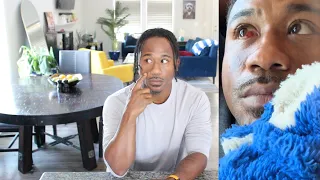 what REALLY happened to my Eye ?!? | Alonzo Lerone