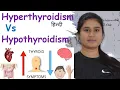 Hyperthyroidism vs Hypothyroidism Difference Thyroid Symptoms