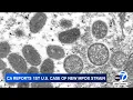 1st known US case of new strain of mpox is confirmed in California