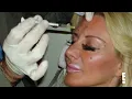 Sarah Spent $3 MILLION on 300 Surgeries to Repair Her Destroyed Face?! | Rejected By Botched | E!