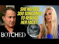 Sarah Spent 3 MILLION on 300 Surgeries to Repair Her Destroyed Face Rejected By Botched E