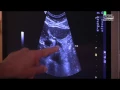 Gary Goldberg MD Testimonial for Gulfcoast Ultrasound Institute