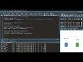 11 R-Programming Machine Learning in R Decision Trees