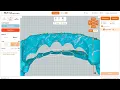 SMA Maker How to Apply Trimline Support with Negative Attachments Pressure Points