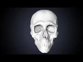 Subdural Hematoma Animation