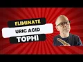Gout Eliminate Uric Acid Tophi
