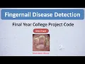 Fingernail Disease Detection Using Deep Learning CNN Image Processing Matlab Project Code