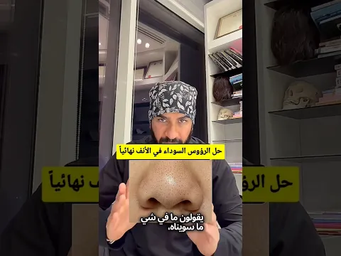 علاج الرؤوس السوداء في الأنف نهائياً