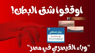 مخاطر الولادة القيصرية وتحذيرات الصحة العالمية مجتمع شق البطون وباء القيصري يلغي الولادة الطبيعية 