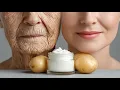 Download Lagu 🥔🥔 Natuurlijke collageenboost!  Verwijder rimpels op 75-jarige leeftijd!  Gouden Anti-Aging Gezichts