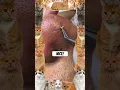 Download Lagu Wow! #pimple #pimplepopper #pimples #shortsfeed #shortvideo #shorts #short #youtubeshorts #youtube