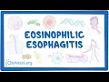 Download Lagu Eosinophilic esophagitis (NORD)