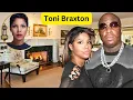 Toni Braxton Exposed Health Struggles Iconic Career Resilience Secrets You Need To Know-2025