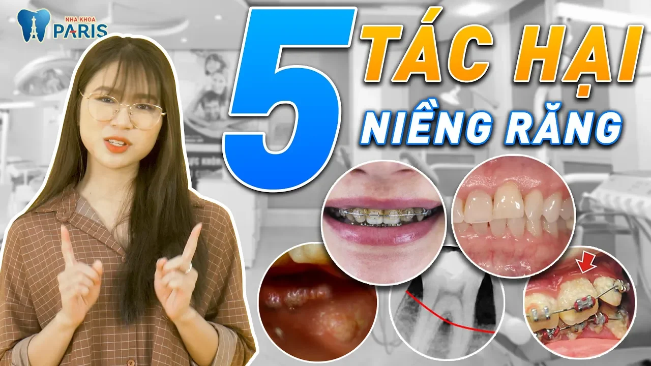 Outline Video Tác hại của niềng răng mà bác sĩ không nói với bạn | Nha khoa Paris