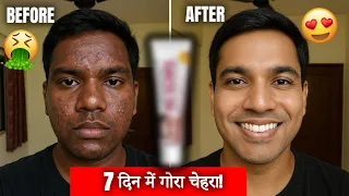 7 दिन में गोरा करने वाली क्रीम 🔥 Fairness Cream