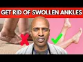 WATCH This BEFORE You Take A WATER PILL