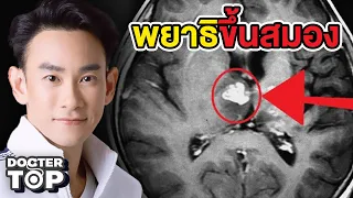 อาหารไทยชนิดใดที่มีความเสี่ยงต่อการติดเชื้อพยาธิที่อาจขึ้นสมองได้บ้าง