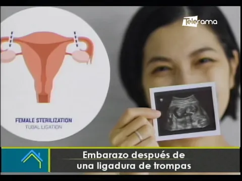 Embarazo después de una ligadura de trompas