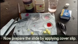 Dicot leaf anatomy 11th biology practical Monocot leaf anatomy Exploring Leaf Anatomy biolab