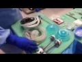 BASIC SET UP LAP CHOLECYSTECTOMY