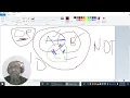 How to use the boolean operator OR in PubMed Easy tutorial for beginners in health research