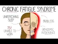 Myalgic Encephalomyelitis Chronic Fatigue Syndrome Includes Criteria Treatment