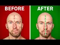 Download Lagu Fix Asymmetrical Jaw \u0026 Face (In Under 1 Minute a Day)