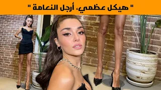 الممثلة هاندا أرتشيل تتعرض لموجة من السخرية بسبب نحافتها المفرطة وشكل ساقيها  الممثلة هاندا أرتشيل تتعرض لموجة من السخرية بسبب نحافتها المفرطة وشكل ساقيها