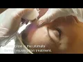 NEW Venus Glow Treatment at Artistic Esthetic Medi Spa