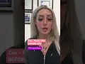 Voicefem - Before after Zae s Voice Feminization Surgery