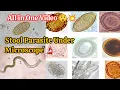 Stool Parasites Under Microscope All in one MLTclass