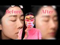 you won t like the results of my LED light therapy experiment