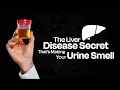 The Liver Disease Secret That s Making Your Urine Smell