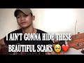 Download Lagu Beautiful Scars - Jong Madaliday