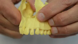 Maxilla Adjustment