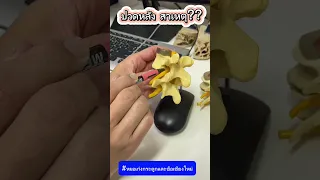  ทำไมกระดูกสันหลังจึงมีโอกาสหักได้ง่าย และเกิดจากสาเหตุอะไรบ้าง 