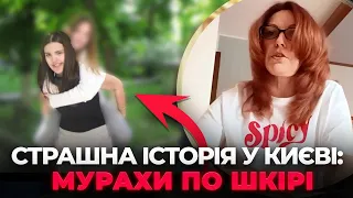 Киевлянка после падения в кипяток находится в коме — эксклюзив - 285x160