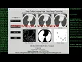 Lung Nodule Segmentation Using Image Processing With Source Code Python Tensorflow OpenCv Project