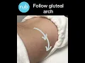 Rub Massage - Glute Release using Dry Needling Mobilisation