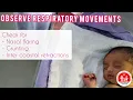 CVS focused Physical Examination