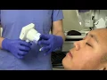 NPi -200 Pupillometer Pupil Exam