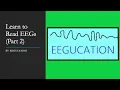 Learn to Read EEGs Part 2