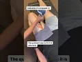 Download Lagu What Happens When Your Femoral Nerve Gets Stuck?